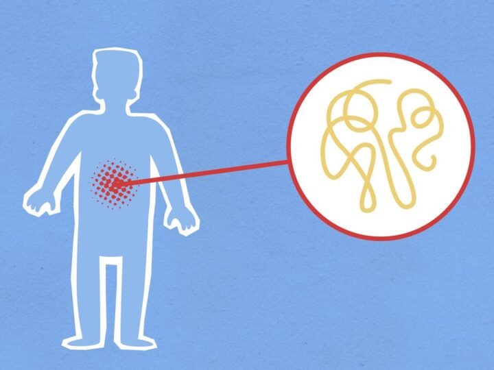 Gastroenterite: 9 causas, sintomas e cuidados básicos!