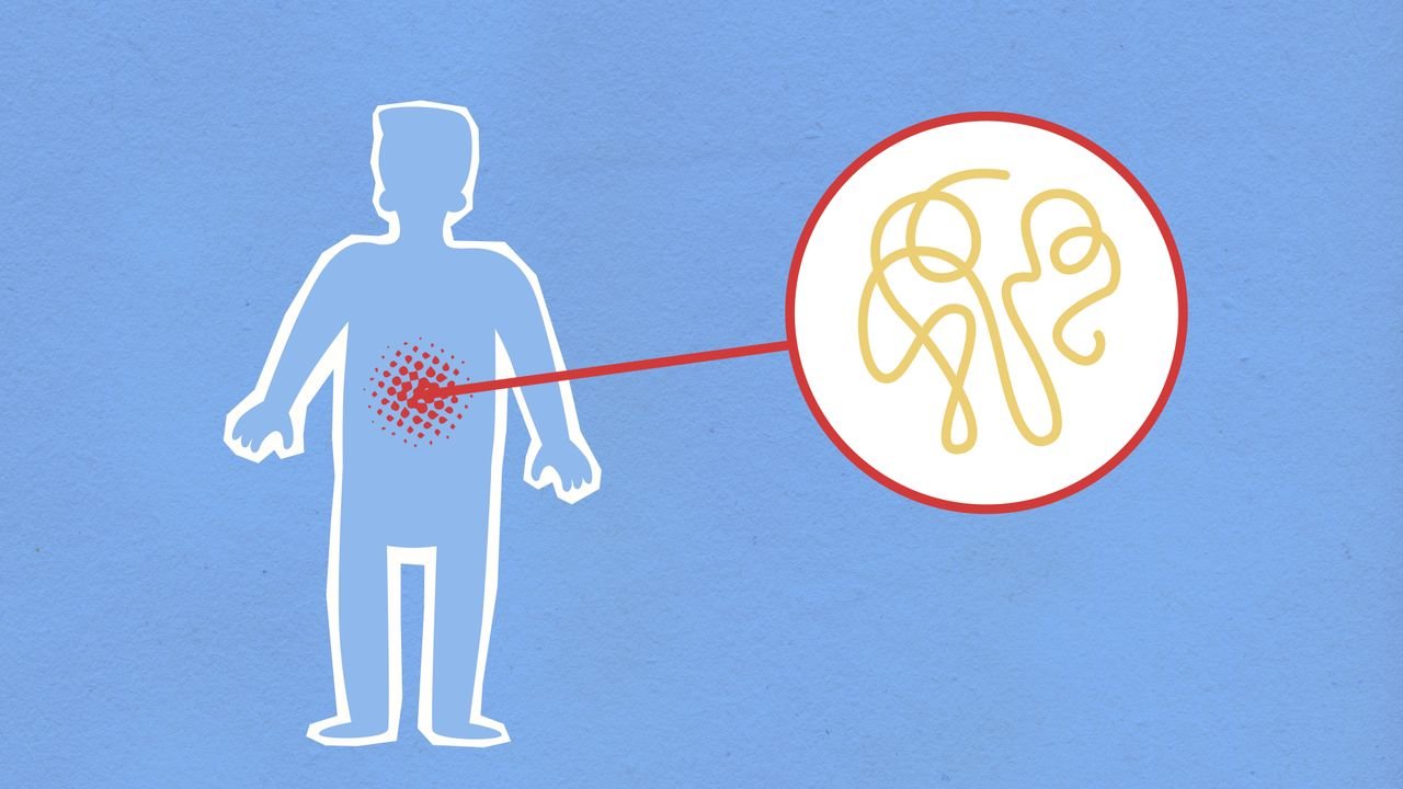 Gastroenterite: 9 causas, sintomas e cuidados básicos!