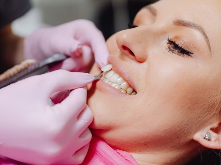 O que são facetas dentárias e quando elas são indicadas?