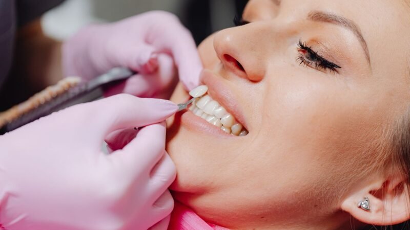 O que são facetas dentárias e quando elas são indicadas?