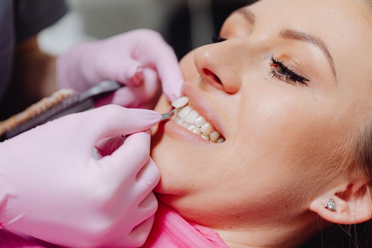 O que são facetas dentárias e quando elas são indicadas?